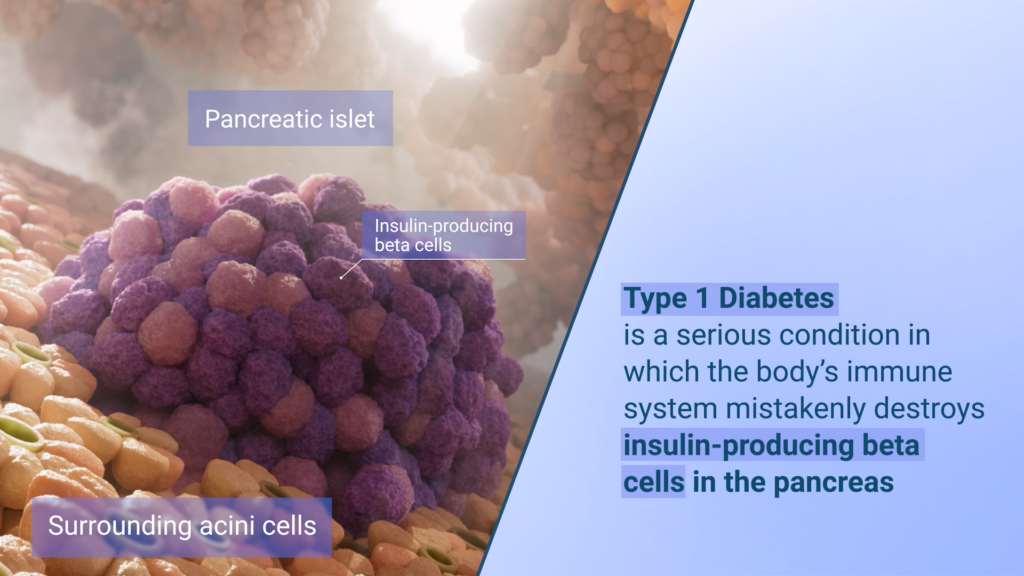 041726 OSLENT4425 ENT1DEP Final Pancreatic Islet.Still002