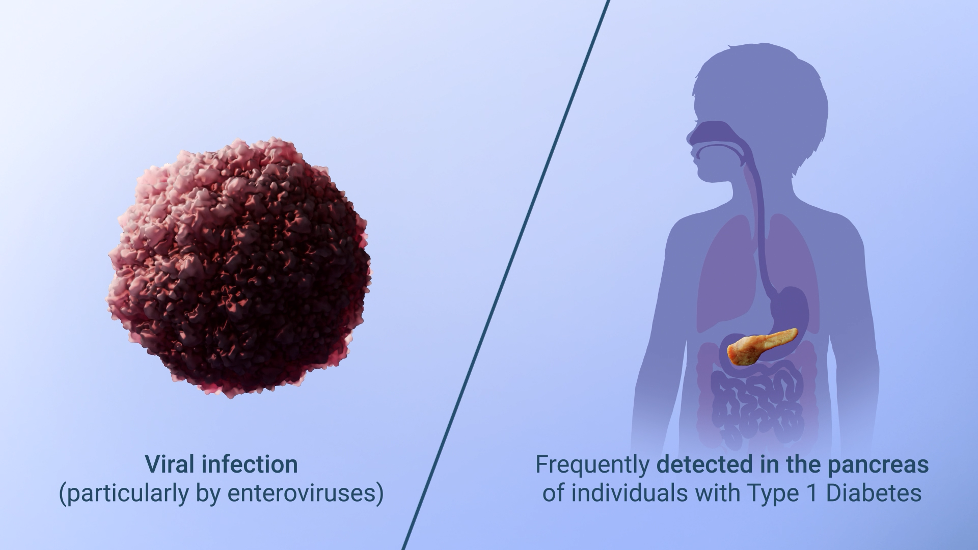 041726 OSLENT4425 ENT1DEP Final Virus ChildPancreas.Still003